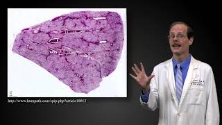 Methotrexate  Interaction with Probenecid [upl. by Annahsal]