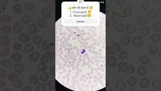 Neutrophil VS Eosinophil 🤔 what shortsvideo wbc bloodcells bloodtest [upl. by Atinauj]