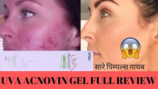 UVA ACNOVIN GEL BEST AYURVEDIC ACNE PIMPLE REMEDY [upl. by Gena]