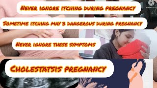 ITCHING DURING PREGNANCY 😑 MY EXPERIENCE WITH CHOLESTASIS OF PREGNANCYitchingduringpregnancy [upl. by Lora]