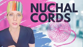 Nuchal cords during pregnancy and childbirth and complications [upl. by Tori]