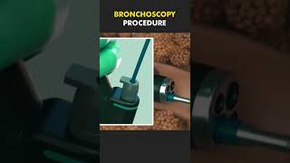 bronchoscopy procedure bscnursing ytshorts medicalstudent doctor lungs nursing [upl. by Idisahc]