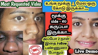 Remove Dark line on the noseமூக்கு 👃 மேல ஒரு கோடு இருக்காnose black pigmentation remove [upl. by Ennirac224]