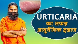 Ayurvedic Treatment Of Urticaria शीतपित्त  Swami Ramdev [upl. by Riggs]