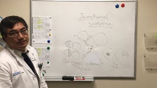 Junctional Scotoma [upl. by Signe]