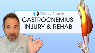 Gastrocnemius Calf Injury and Strain  Expert Explains Mechanism Of Injury and Rehab Plan [upl. by Eatnuahc]