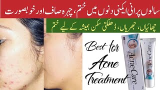 acne care cream  davis acne care cream  acne care cream review  acne ka ilaj  acnetreatment [upl. by Artamas]