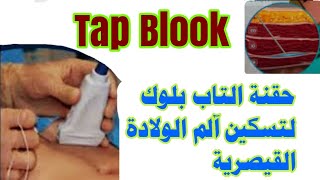 حقنة التاب بلوكTap Block لتسكين آلم الولادة القيصرية [upl. by Ajin350]