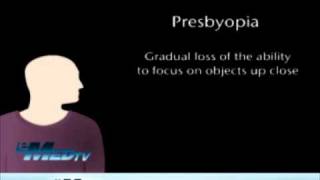 Presbyopia  Gradual Loss of Sight [upl. by Malvin]