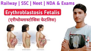 What Is Erythroblastosis Fetalis Erythroblastosis Fetalis In Hindi  Haemolytic Disease  Ravi Sir [upl. by Lubin928]