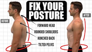 How To FIX Your Posture  10Minute Daily Routine [upl. by Aramak]