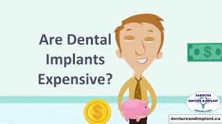 Dentures on Dental Implants [upl. by Azyl228]