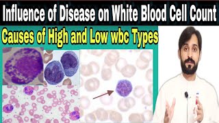 Influence of disease on white blood cell count  Causes of low and high wbc types [upl. by Shadow]