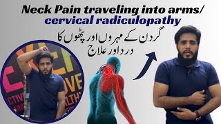 Pinched nerve in neck  C4C5C6 Cervical Radiculopathy  physical therapy treatment [upl. by Zachariah]