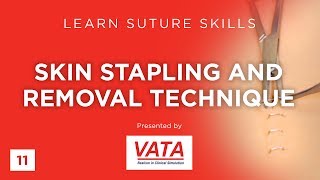 Skin Stapling and Removal Technique  Learn Suture Techniques  VATA [upl. by Lengel790]