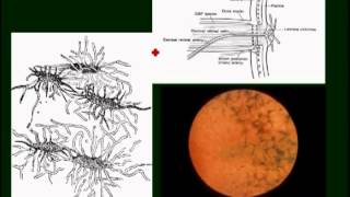 neuroophthalmology pt4 [upl. by Di357]