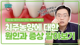 건강하십쇼show 치주농양잇몸농양에 대한 원인과 증상 [upl. by Middlesworth465]