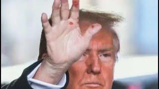 What Is Going On With The Red Splotches On Trumps Hand [upl. by Charity]