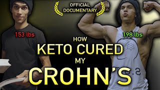 How Keto Cured My Crohns  Official Documentary [upl. by Ruelu]