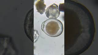 Foraminifera using its pseudopodia 😮 [upl. by Ressan]