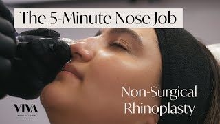 The 5Minute Nose Job 🟡 The NonSurgical Rhinoplasty by VIVA Skin Clinics [upl. by Ogilvie]