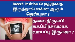 Breech Position of baby during pregnancy in Tamil  when baby fix in cephalic position in tamil [upl. by Shaya270]