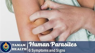 6 Symptoms of Human Parasites Everyone Should Know [upl. by Putscher]