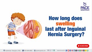 How long does swelling last after Inguinal Hernia Surgery  InguinalHerniaSurgery [upl. by Anirres]