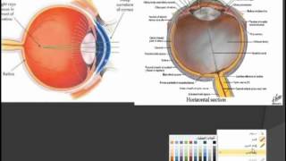 errors of refraction pt 3 [upl. by Nevets103]