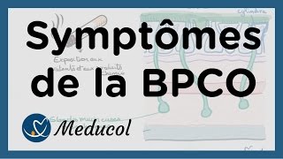 Physiopathologie et symptômes dune bronchite chronique BPCO [upl. by Gulick]