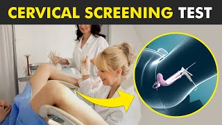 Pap Smear Pap Test  Early Detection for Cervical Cancer  Understanding the Procedure [upl. by Hoashis]