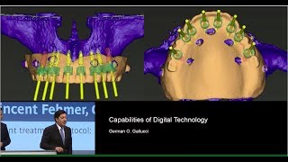 Prof German O Gallucci Capabilities of Digital Technology [upl. by Aileda]