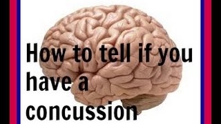 On the field 2 minute concussion test [upl. by Aisyat]