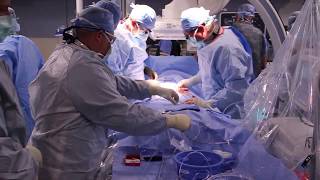 Watch a Transcatheter Aortic Valve Replacement TAVR Procedure at St Lukes in Cedar Rapids Iowa [upl. by Diannne]