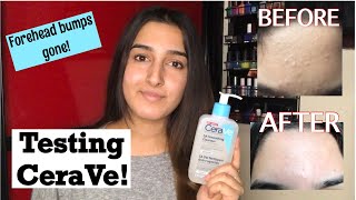 Testing CeraVe SA Smoothing Cleanser And Cream  Cure Forehead Bumps And Keratosis Pilaris [upl. by Enilrek85]