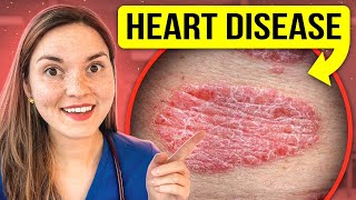 What Your SKIN Says About Your HEALTH  PART 2 Doctor Explains [upl. by Adnwahsar]