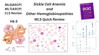 Sickle Cell Anemia and Other Hemoglobinopathies [upl. by Eelyek496]