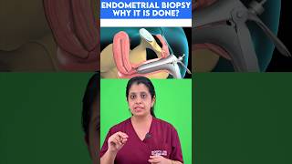 Endometrial biopsy  Why it is done [upl. by Meece700]