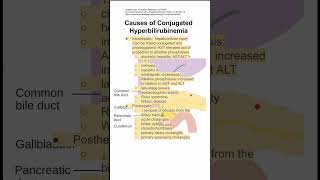 Causes of Conjugated Hyperbilirubinemia [upl. by Joby]