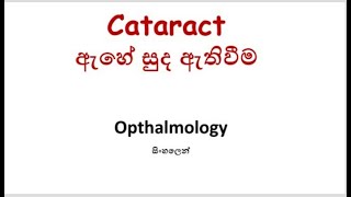 Cataract  Ahe suda  Opthalmology  In Sinhala [upl. by Jezabella589]