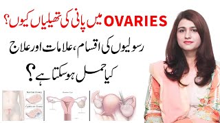 Anda Dani Ki Rasoli Ka Ilaj  Ovarian Cyst Signs And Symptoms  Dr Maryam Raana Gynaecologist [upl. by Philipa]