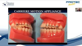 WEBINAR Carriere Motion Appliance [upl. by Ateerys]