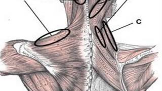 Right Side Upper Back Pain  How To Obtain Relief [upl. by Adrial]