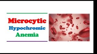 Hematology 🔤  Microcytic Hypochromic Anemia [upl. by Larson]