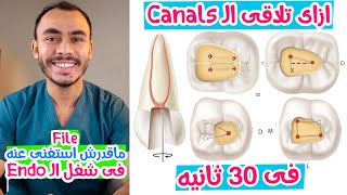 Tips and Tricks to find Endodontic Root Canal After Access Cavity Preparation [upl. by Calvo12]