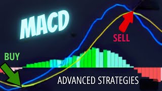 MACD Advanced Trading Strategies for More Wins🚀💥 [upl. by Laicram]