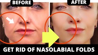 🛑 HOW TO LIFT SMILE LINES  GET RID OF LAUGH LINES WITH FACE YOGA  JOWLS SAGGY SKIN JAWLINE [upl. by Jo589]