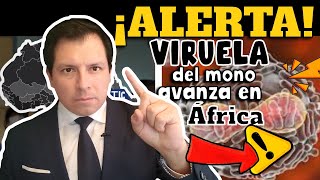 ALERTA⚠️ VIRUELA DEL MONO AVANZA EN ÁFRICA [upl. by Lesya756]