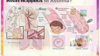 Asthma inhaler and spacer usePart 1 [upl. by Sama963]