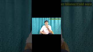 Fever blistersCold sore treatment medicine ointment shorts ytshorts drniteshraj [upl. by Wj]